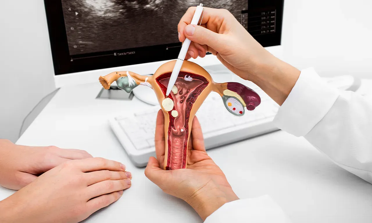 Fibroid Treatment