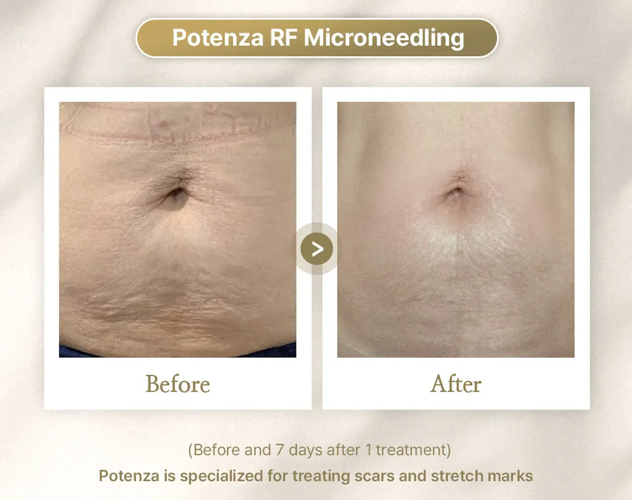 potenza before and after
