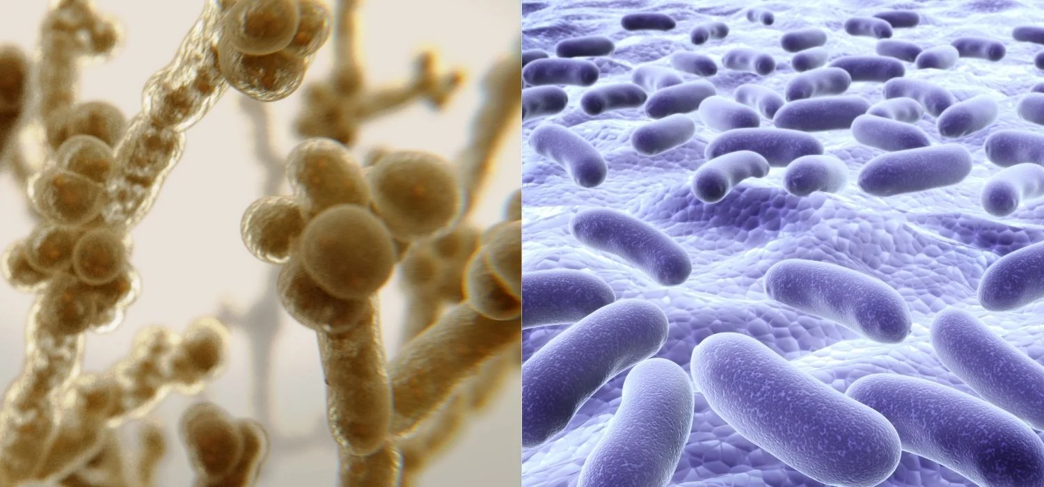 BV_vs._Yeast_Infection__How_to_Tell_the_Difference_and_Get_Relief_aca81ea5-c91b-4af9-b163-4f80c0500a3e