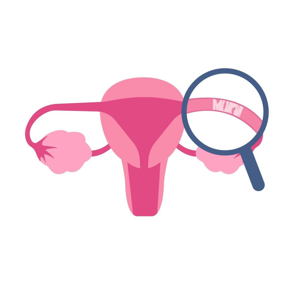 blocked-fallopian-tubes-concept-illustration-good-to-use-for-medical-or-science-content-vector